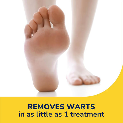 Dr. Scholl�s FreezeAway Wart Remover, 12 Applications // Doctor-Proven Treatment to Rapidy Freeze and Remove Common and Plantar Warts