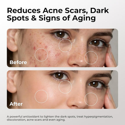 20% Vitamin C & E Plus Ferulic Acid Serum Rejuvenates Skin to Fresh & Beautiful w/Super Antioxidant That Powerfully Neutralizes Free Radicals to Brighten Skin