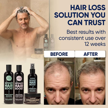 Moerie Shampoo and Conditioner Plus Hair Mask and Spray Mega Pack – The Ultimate Growth Care – For Longer, Thicker, Fuller Hair - Volumizing Products – Paraben & Silicone Free (Set of 4)