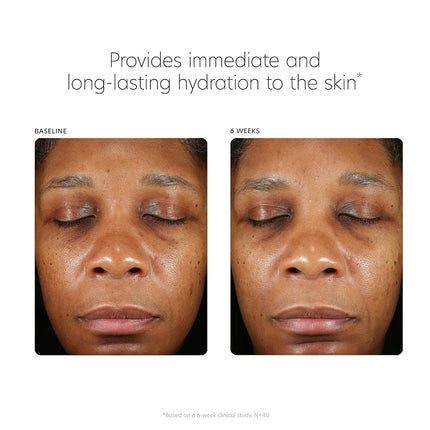 Hyaluronic Acid Boosting Serum by PCA Skin for Unisex - 1 oz Serum