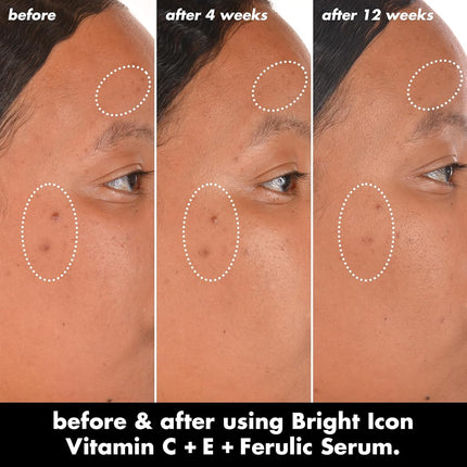 e.l.f. SKIN Bright Icon Vitamin C + E + Ferulic Serum, Brightening & Soothing Face Serum, Helps Even Skin Tone, Vegan & Cruelty-Free, 1 fl oz