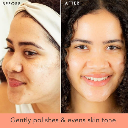 Gommage et nettoyant pour le visage microdermabrasion bio, ingrédients naturels et biologiques, nettoyant exfoliant pour un nettoyage en profondeur des pores et anti-âge, idéal pour l'acné, les peaux sèches, grasses ou sensibles des hommes et des femmes.