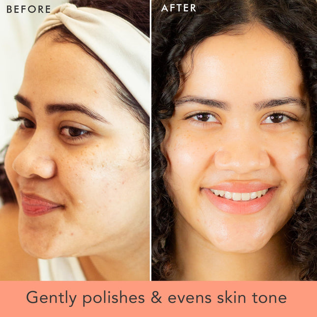 Exfoliante Facial y Limpiador de Microdermoabrasión Orgánica, Ingredientes Naturales y Orgánicos, Limpiador Facial Exfoliante para Limpieza Profunda de Poros y Antienvejecimiento, Ideal para Hombres y Mujeres con Acné, Piel Seca, Grasa o Sensible