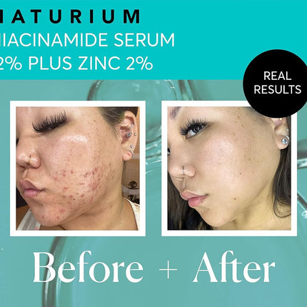 Naturium Niacinamide Serum 12% Plus Zinc 2% (30 ML / 1.0 Fl OZ) - Purifies and Refines Complexion - With Highly Concentrated Niacinamide and Zinc PCA - Dermatologically Tested