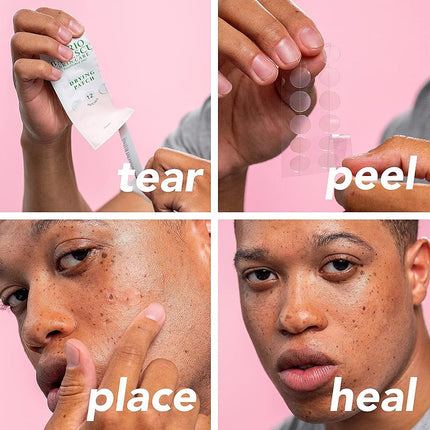 Mario Badescu Kit antimanchas AM/PM, incluye loción secante para el tratamiento de manchas con ácido salicílico y azufre, 1 fl oz Y parches secantes para cubrir granos, tratamiento invisible para manchas, 12 parches