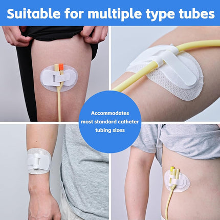 60 PCS Catheter Stabilization Devices, Foley Catheter Supplies, Urinary Leg Bag Legband Holder Sticker, Self Adhesive Catheter Tube Holder for PEG/G/Feeding Tube（White）