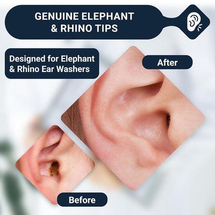 Doctor Easy Elephant & Rhino Ear Washer Disposable Tips, Bag Of 20