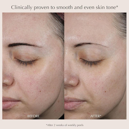 EXUVIANCE Performance Peel AP25 At-Home Chemical Peel with Glycolic, Mandelic and Polyhydroxy Acids, 13 ct.