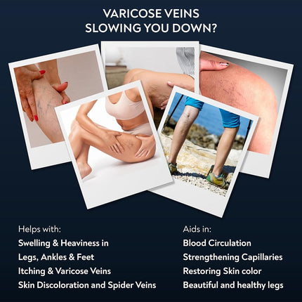Penikosete Varicose Veins Cream | Natural Ayurvedic Cream for Legs with Ashwagandha | Spider Vein Removal Cream for Improved Circulation & Relief From Heavy Fatigued Legs | Non-Sticky