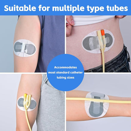 60 PCS Catheter Stabilization Devices, Foley Catheter Supplies, Urinary Leg Bag Legband Holder Sticker, Self Adhesive Catheter Tube Holder for PEG/G/Feeding Tube（Gray）
