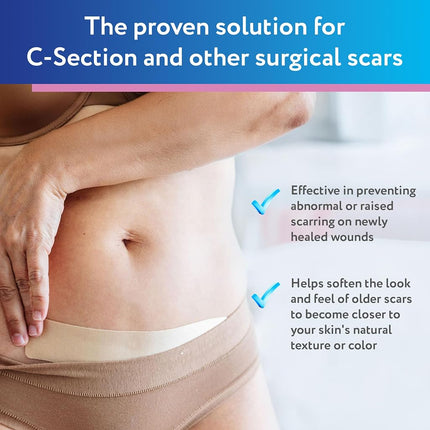 ScarAway C-Section Scar Sheets, Medical Grade Silicone, Tan, 1.5x7in, 4 Ct