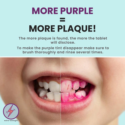 Plaque Disclosing Tablets for Teeth, 96 Count, Dental Disclosing Tablets for Kids or Adults, Shows Plaque, Helps Teach Kids Teeth-Brushing Habits for Clean Smile, by Fresh Knight, (Pack of 1)