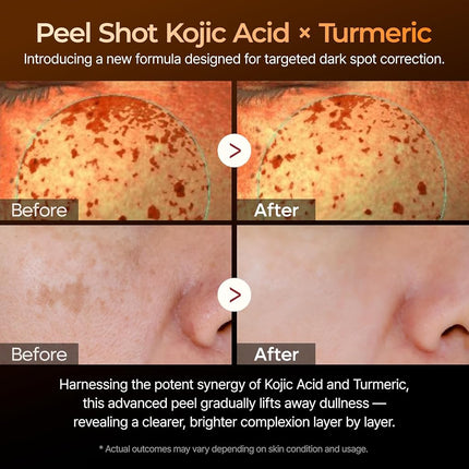 Dr.Melaxin Peel Shot Exfoliating Serum with Kojic Acid and Turmeric for Brightening and Exfoliation 80ml