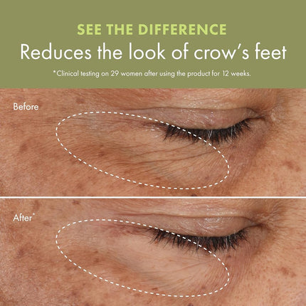 Plantscription Wrinkle Correction Eye with encapsulated Retinol 15 ml