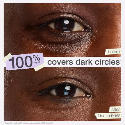 tarte shape tape concealer – Full Size-Coverage, Matte Finish for Under Eye, Dark Circles, Fine Lines, Redness & Discoloration, Longwear, Dermatologist-Tested, Vegan, Cruelty-Free