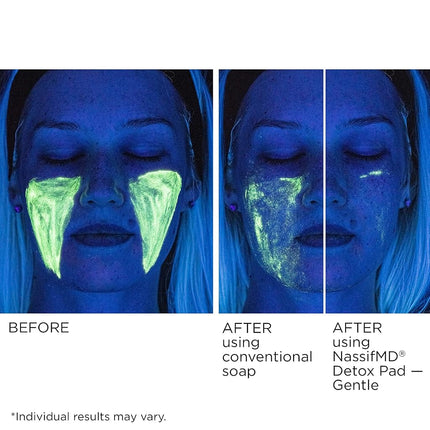 Toallitas exfoliantes suaves Detox de NassifMD, complejo de ácidos frutales creado por un cirujano para pieles sensibles, ilumina, exfolia y reduce las arrugas, probado por dermatólogos