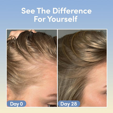 Coco & Eve Boost Therapy Tripeptide Hair Density Serum. For Thicker, Fuller Hair. Anti-Hair Loss & Shedding, Lightweight Scalp Treatment with Biotin & Caffeine for Volume & Restoration (60 ml)