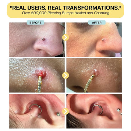 BASE LABORATORIES Piercing Bump & Keloid Bump Removal Solution | Soothing Piercing Aftercare | Bump Keloid Scar Removal | Ear & Nose Piercing Cleaner for Keloid Bumps | Piercing Aftercare Oil | 2PK