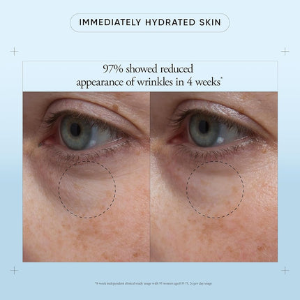 Philosophy Hope In A Jar Eye Moisturiser 15Ml