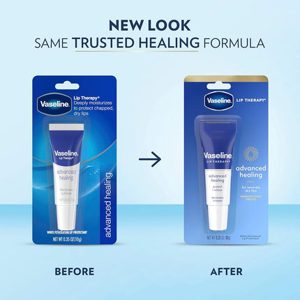 Vaseline Lip Therapy Lip Balm Tube For healthier looking lips Advanced Healing Moisturizer For Dry Lips 0.35 oz