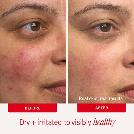 First Aid Beauty - Ultra Repair Cream - Hydrating Face & Body Moisturizer - Whipped Colloidal Oatmeal Clinically Proven to Strengthen Skin Barrier in 7 Days - Helps Relieve Eczema, 2 oz Travel Size