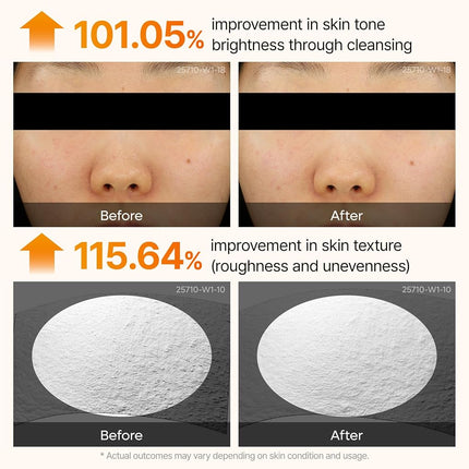 Dr.Melaxin Peel Shot Exfoliating Serum with Kojic Acid and Turmeric for Brightening and Exfoliation 80ml