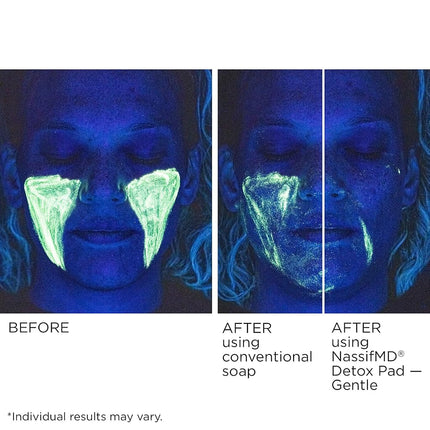 Toallitas exfoliantes suaves Detox de NassifMD, complejo de ácidos frutales creado por un cirujano para pieles sensibles, ilumina, exfolia y reduce las arrugas, probado por dermatólogos