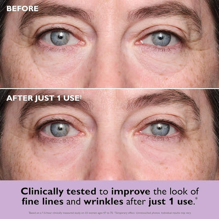 Peter Thomas Roth | Instant FIRMx® Collagen Tightening Eye Patches | Eye Patches For Firming Under-Eye Bags & Wrinkles | Eye Masks For Puffiness