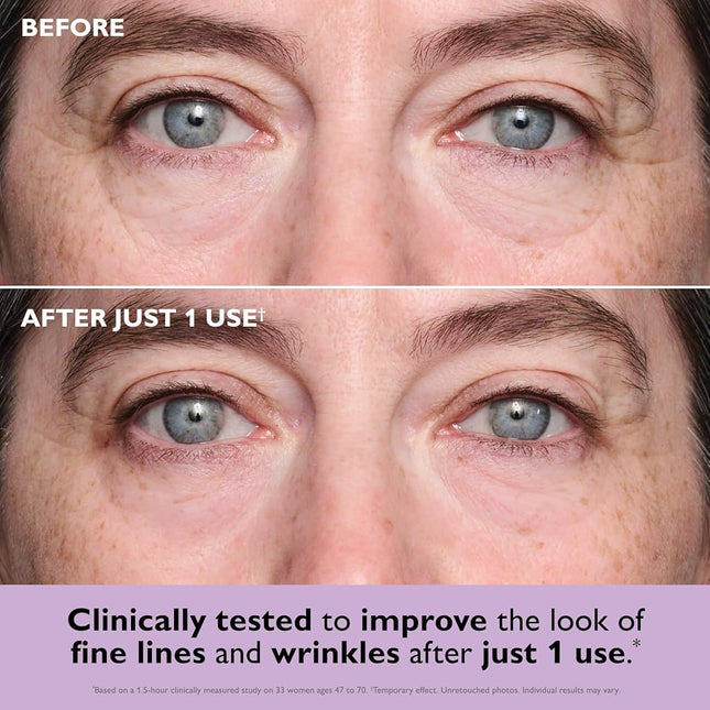 Peter Thomas Roth | Instant FIRMx® Collagen Tightening Eye Patches | Eye Patches For Firming Under-Eye Bags & Wrinkles | Eye Masks For Puffiness