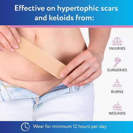 ScarAway C-Section Scar Sheets, Medical Grade Silicone, Tan, 1.5x7in, 4 Ct
