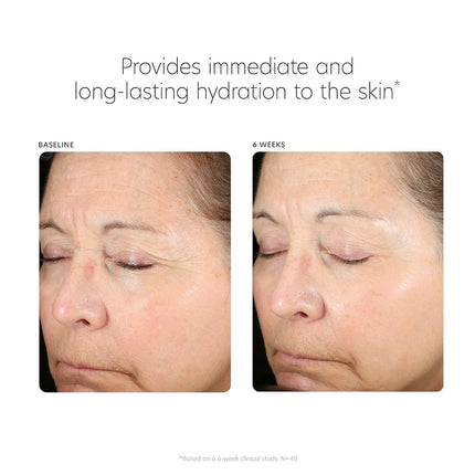 Hyaluronic Acid Boosting Serum by PCA Skin for Unisex - 1 oz Serum