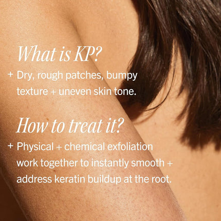 First Aid Beauty KP Bump Eraser Body Scrub with 10% AHA, Keratosis Pilaris Skin Exfoliator with Glycolic and Lactic acids, Helps Reduce Chicken Bumps, Safe for Sensitive Skin, 8 oz