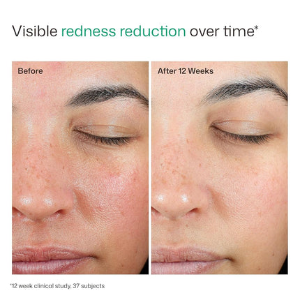 EltaMD EltaMD UV Skin Recovery Red Colour Correcting Green Tint Face Sunscreen SPF 50 for Unisex - 45 ml Sunscreen