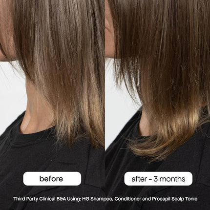 BondiBoost Procapil Hair Tonic 4.23 fl oz - Leave-In Treatment for Thinning Hair - Reduce Hair Fall + Increase Hair Density - Lightweight Non-Greasy Formula - Vegan/Cruelty-Free - Australian Made