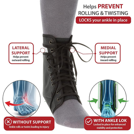 Swede-O Ankle Lok Support with Knit Tongue, Exclusive Lacing System Keeps Brace Tighter Longer, Side Stabilizers Provide Additional Ankle Support, Large, White