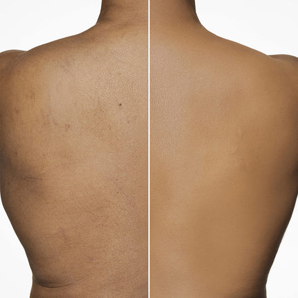 Maquillaje Dermablend para piernas y cuerpo, 45W Tan Honey