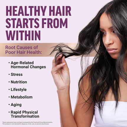 Force Factor Hair Growth Accelerator Soft Chews, Hair Growth Vitamins for Women with Clinically Proven Lustriva and Biotin to Promote Visibly Thicker, Fuller, Stronger Hair, Mixed Berry, 60 Soft Chews