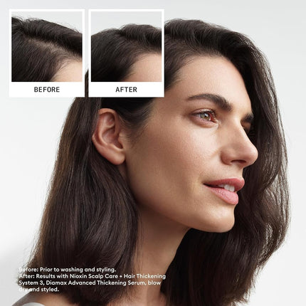 Nioxin System 3 Scalp & Hair Leave-In Treatment, Restore Hair Fullness, Prevent & Relieve Dry Scalp Symptoms, For Color Treated Hair with Light Thinning, 6.8 oz