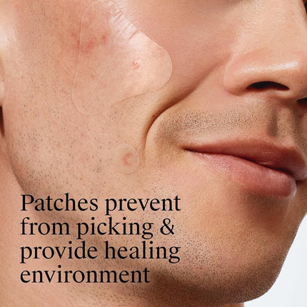 Neutrogena Stubborn Acne Pimple Patches, Acne Treatment for Face, Ultra-Thin Hydrocolloid Spot Stickers Provide Optimal Healing for Pimples, 24 Patches