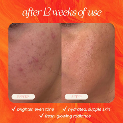 Pineapple & Rosehip Vitamin C Serum