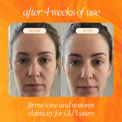 Bakuchiol Skin Renewing Facial Oil (Retinol Alternative)